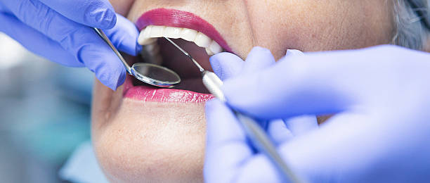 Best Emergency Tooth Extraction in Trenton, NJ